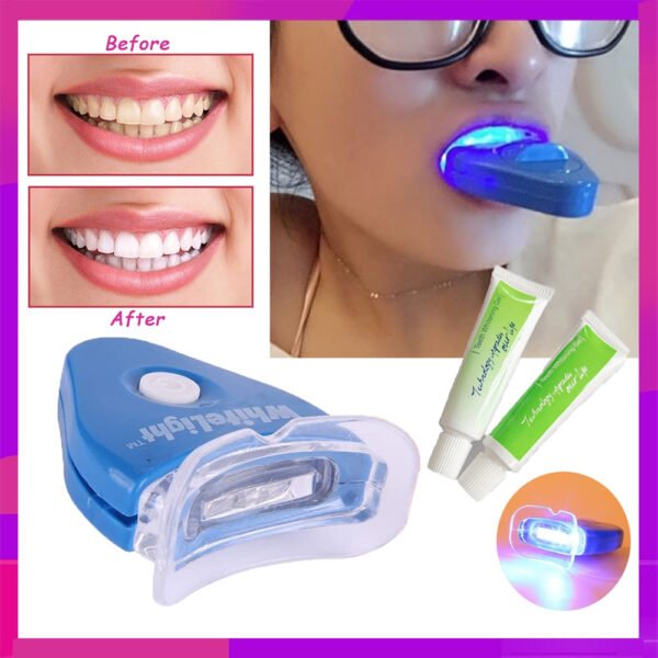 Tooth Whitening System - Image 6